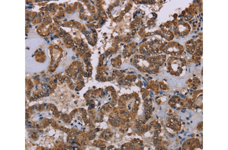 Immunohistochemistry - GRK1 Antibody from Signalway Antibody (36915) - Antibodies.com