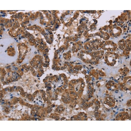 Immunohistochemistry - GRK1 Antibody from Signalway Antibody (36915) - Antibodies.com