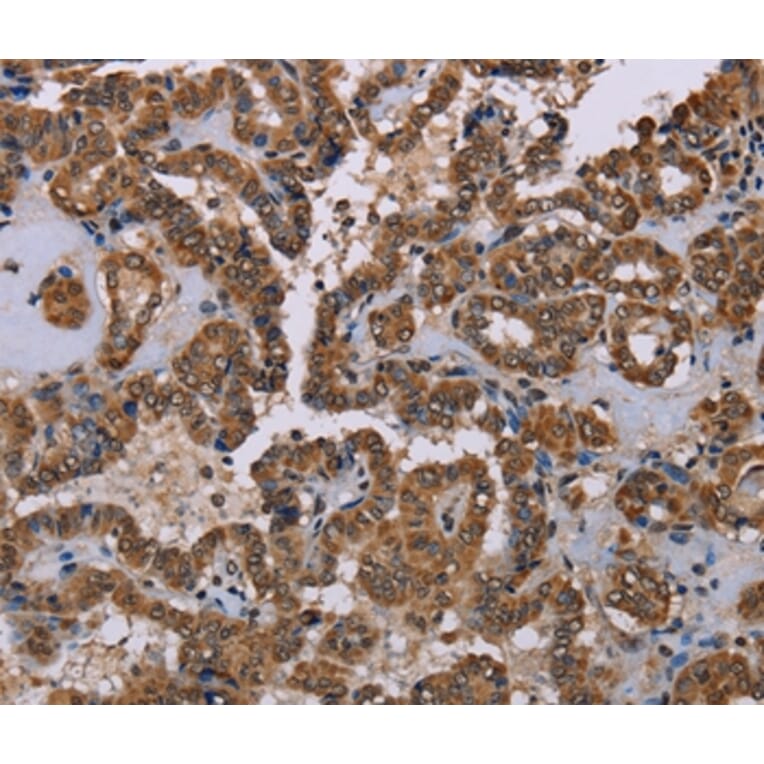 Immunohistochemistry - GRK1 Antibody from Signalway Antibody (36915) - Antibodies.com