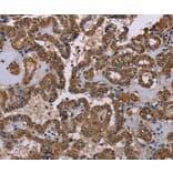 Immunohistochemistry - GRK1 Antibody from Signalway Antibody (36915) - Antibodies.com