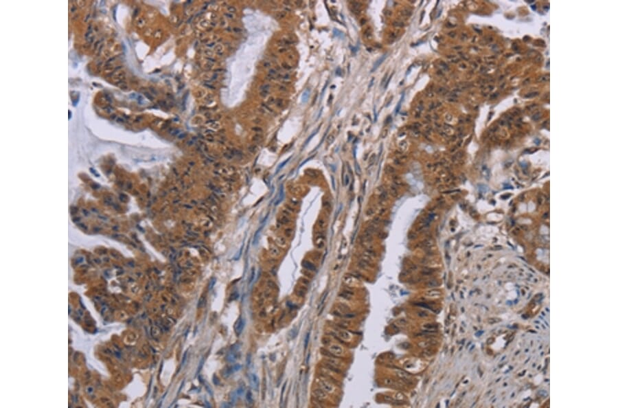 Immunohistochemistry - GRK1 Antibody from Signalway Antibody (36915) - Antibodies.com