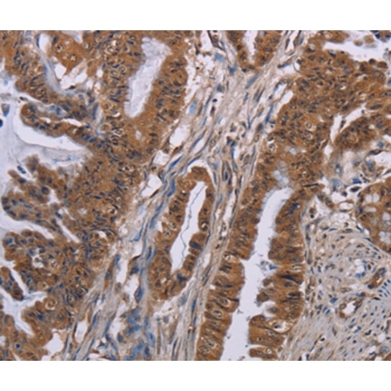 Immunohistochemistry - GRK1 Antibody from Signalway Antibody (36915) - Antibodies.com