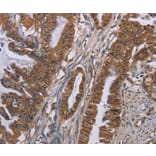 Immunohistochemistry - GRK1 Antibody from Signalway Antibody (36915) - Antibodies.com