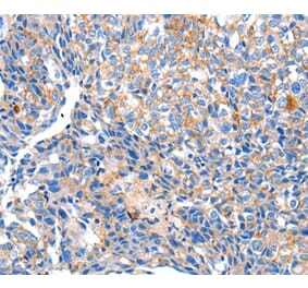 Immunohistochemistry - HCN2 Antibody from Signalway Antibody (36922) - Antibodies.com