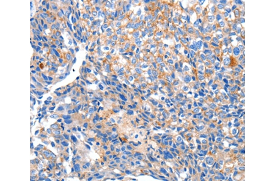 Immunohistochemistry - HCN2 Antibody from Signalway Antibody (36922) - Antibodies.com
