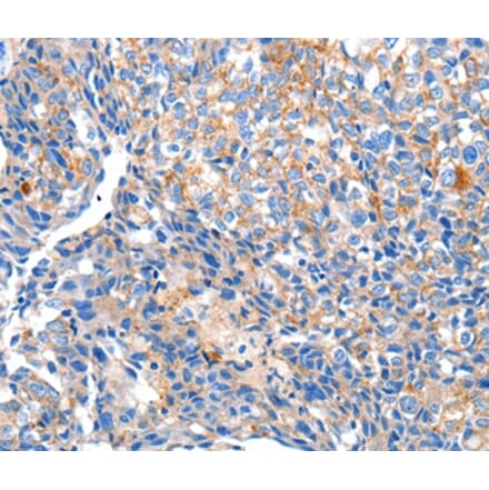 Immunohistochemistry - HCN2 Antibody from Signalway Antibody (36922) - Antibodies.com