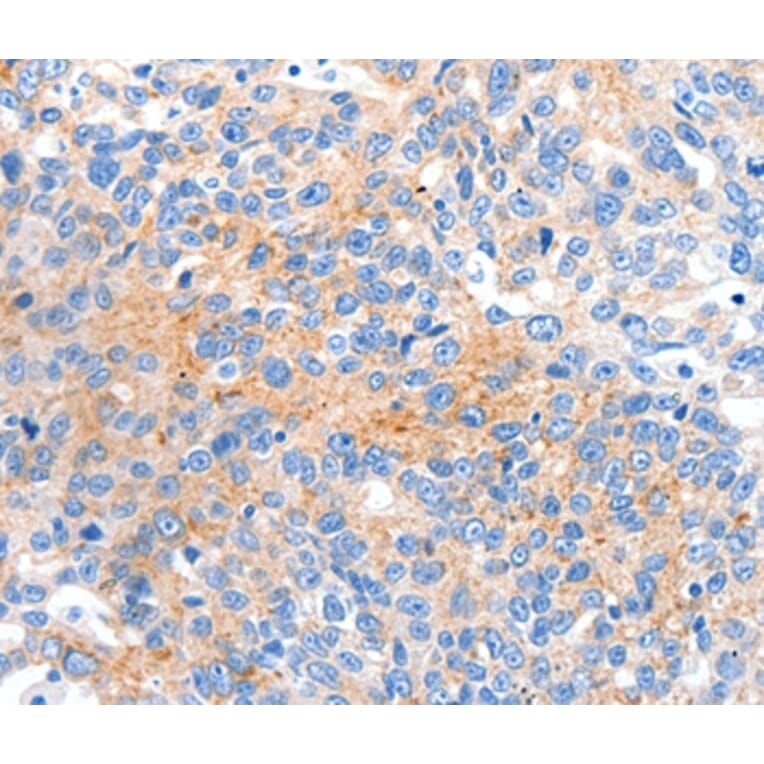 Immunohistochemistry - HCN2 Antibody from Signalway Antibody (36922) - Antibodies.com
