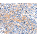 Immunohistochemistry - HCN2 Antibody from Signalway Antibody (36922) - Antibodies.com