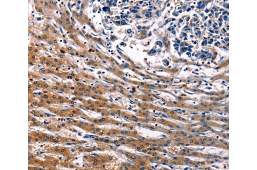 Immunohistochemistry - IRF7 Antibody from Signalway Antibody (36935) - Antibodies.com