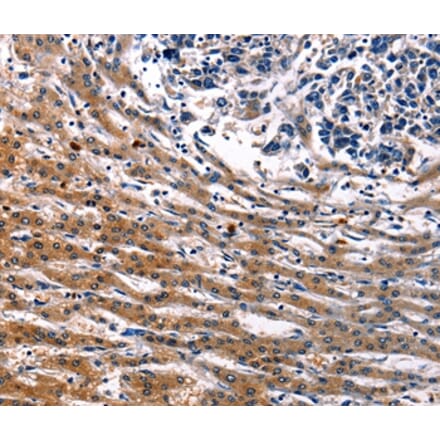 Immunohistochemistry - IRF7 Antibody from Signalway Antibody (36935) - Antibodies.com