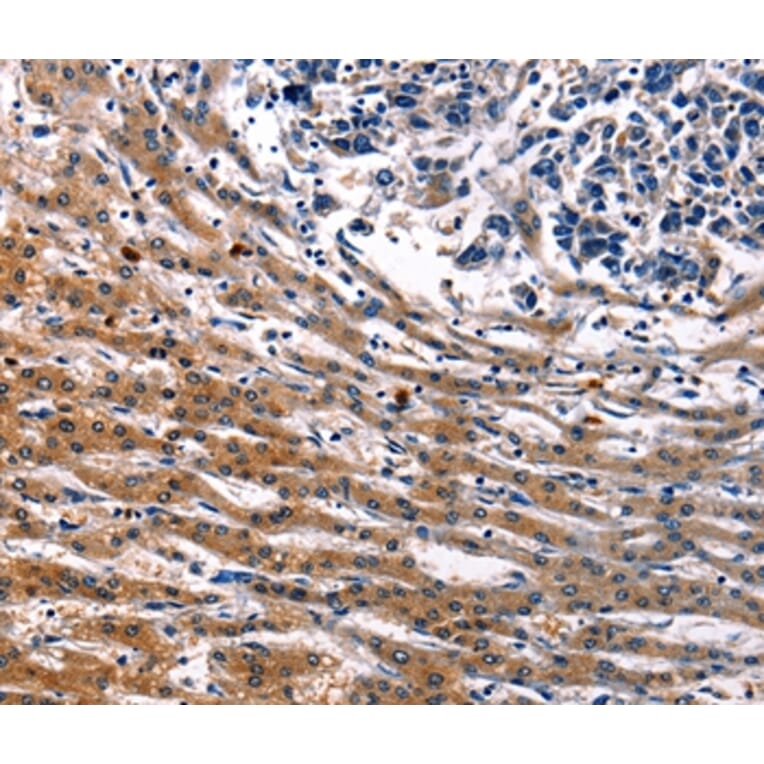 Immunohistochemistry - IRF7 Antibody from Signalway Antibody (36935) - Antibodies.com