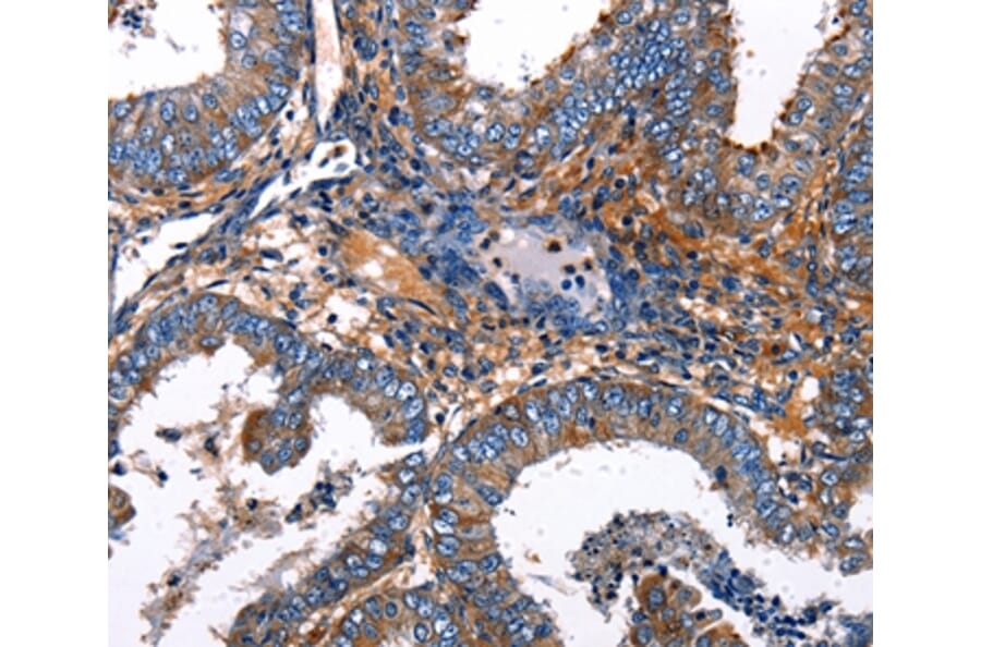 Immunohistochemistry - IRF7 Antibody from Signalway Antibody (36935) - Antibodies.com