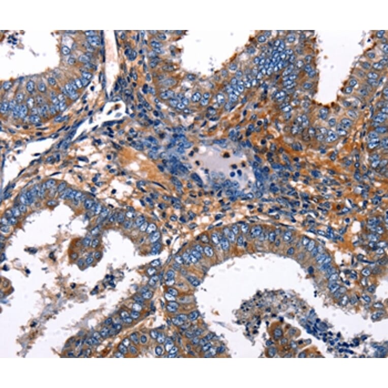 Immunohistochemistry - IRF7 Antibody from Signalway Antibody (36935) - Antibodies.com