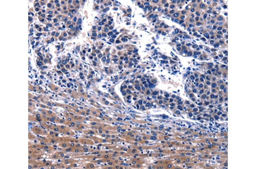 Immunohistochemistry - IRS4 Antibody from Signalway Antibody (36937) - Antibodies.com