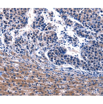 Immunohistochemistry - IRS4 Antibody from Signalway Antibody (36937) - Antibodies.com