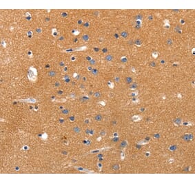 Immunohistochemistry - JAK2 Antibody from Signalway Antibody (36938) - Antibodies.com