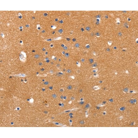 Immunohistochemistry - JAK2 Antibody from Signalway Antibody (36938) - Antibodies.com