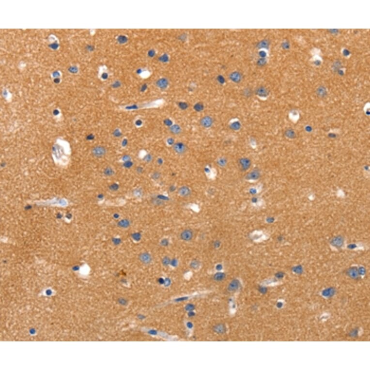 Immunohistochemistry - JAK2 Antibody from Signalway Antibody (36938) - Antibodies.com