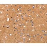 Immunohistochemistry - JAK2 Antibody from Signalway Antibody (36938) - Antibodies.com