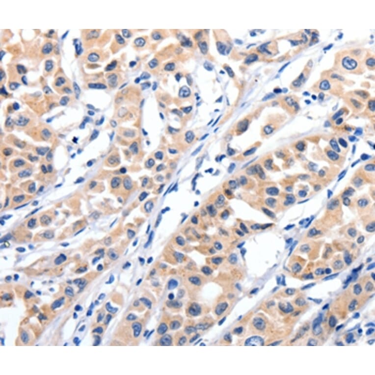 Immunohistochemistry - JAK2 Antibody from Signalway Antibody (36938) - Antibodies.com