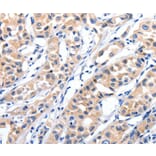 Immunohistochemistry - JAK2 Antibody from Signalway Antibody (36938) - Antibodies.com