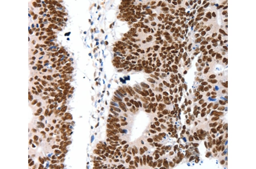 Immunohistochemistry - LIFR Antibody from Signalway Antibody (36951) - Antibodies.com