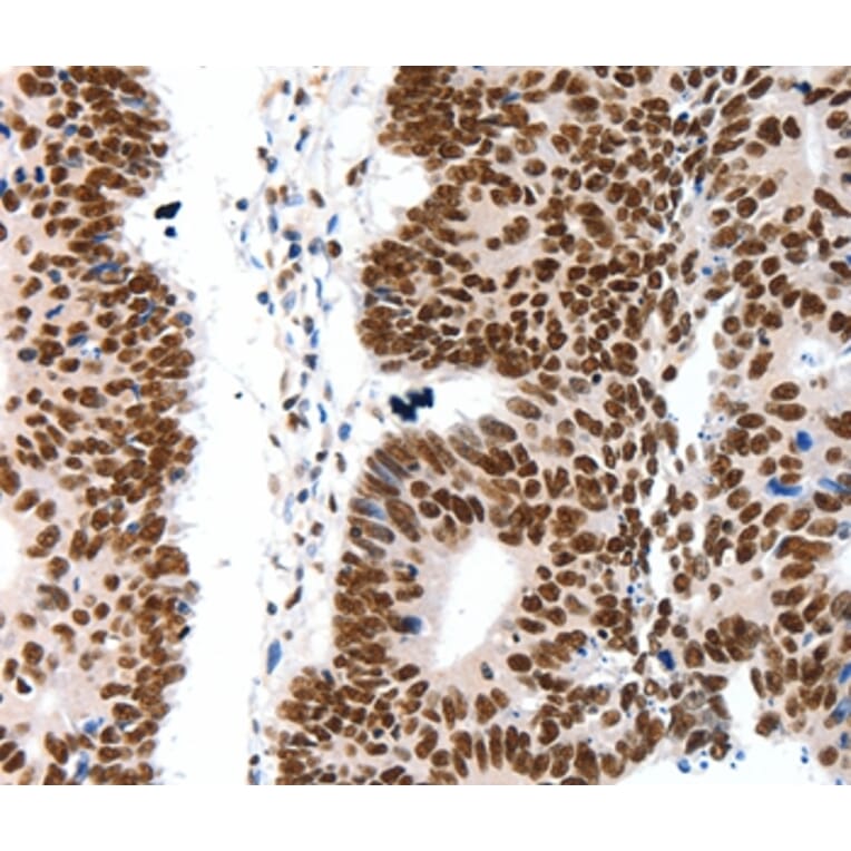 Immunohistochemistry - LIFR Antibody from Signalway Antibody (36951) - Antibodies.com