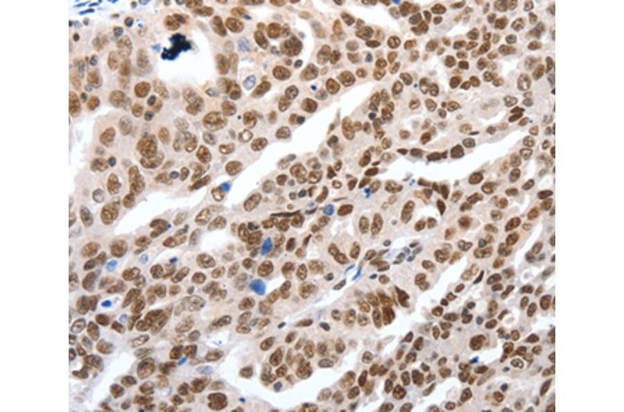 Immunohistochemistry - LIFR Antibody from Signalway Antibody (36951) - Antibodies.com