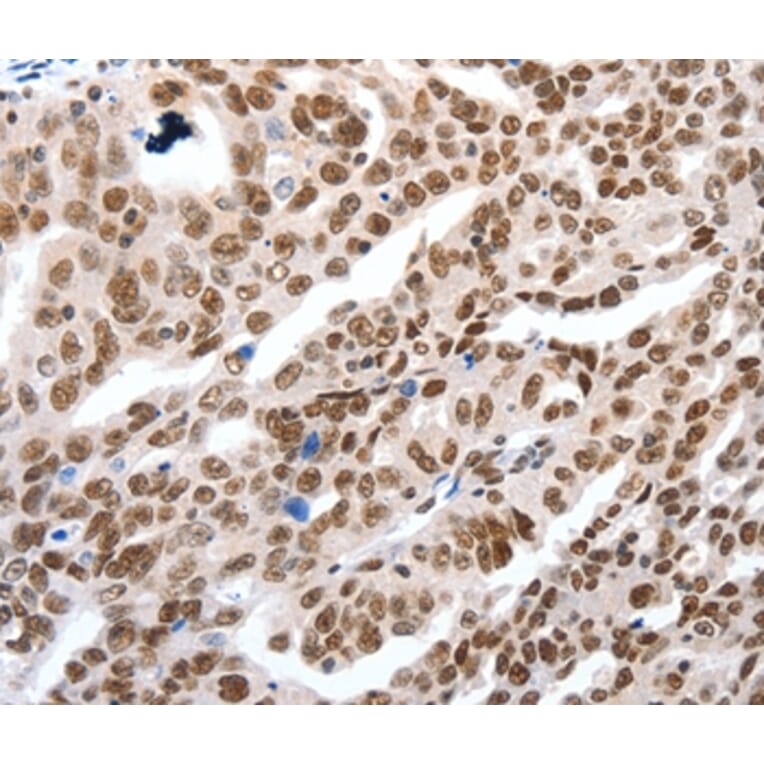 Immunohistochemistry - LIFR Antibody from Signalway Antibody (36951) - Antibodies.com