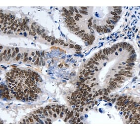 Immunohistochemistry - LRP5 Antibody from Signalway Antibody (36957) - Antibodies.com