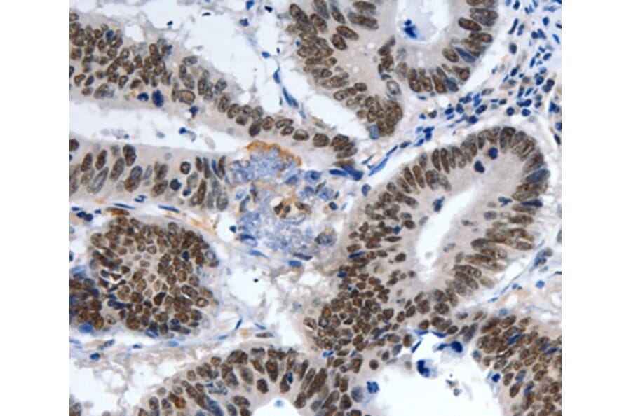 Immunohistochemistry - LRP5 Antibody from Signalway Antibody (36957) - Antibodies.com