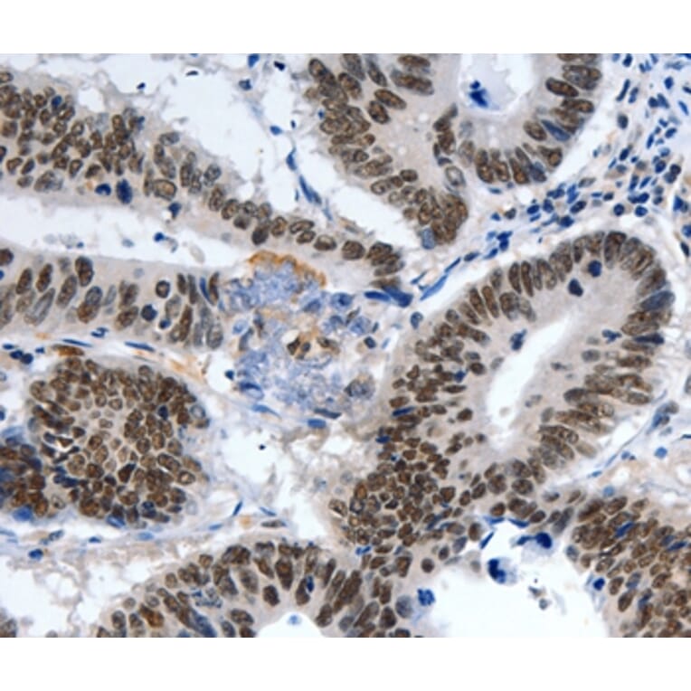 Immunohistochemistry - LRP5 Antibody from Signalway Antibody (36957) - Antibodies.com