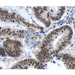 Immunohistochemistry - LRP5 Antibody from Signalway Antibody (36957) - Antibodies.com