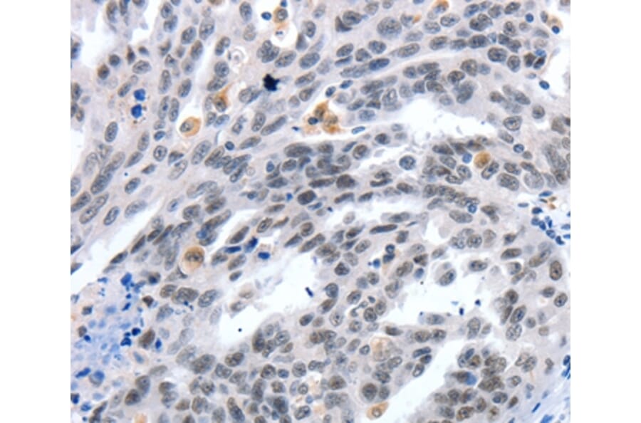 Immunohistochemistry - LRP5 Antibody from Signalway Antibody (36957) - Antibodies.com