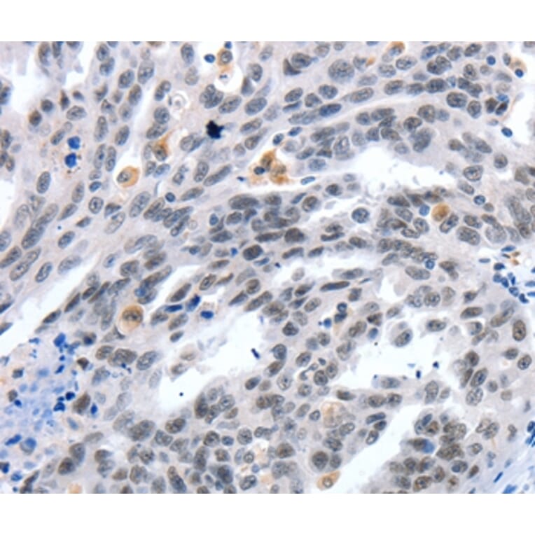 Immunohistochemistry - LRP5 Antibody from Signalway Antibody (36957) - Antibodies.com