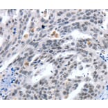 Immunohistochemistry - LRP5 Antibody from Signalway Antibody (36957) - Antibodies.com