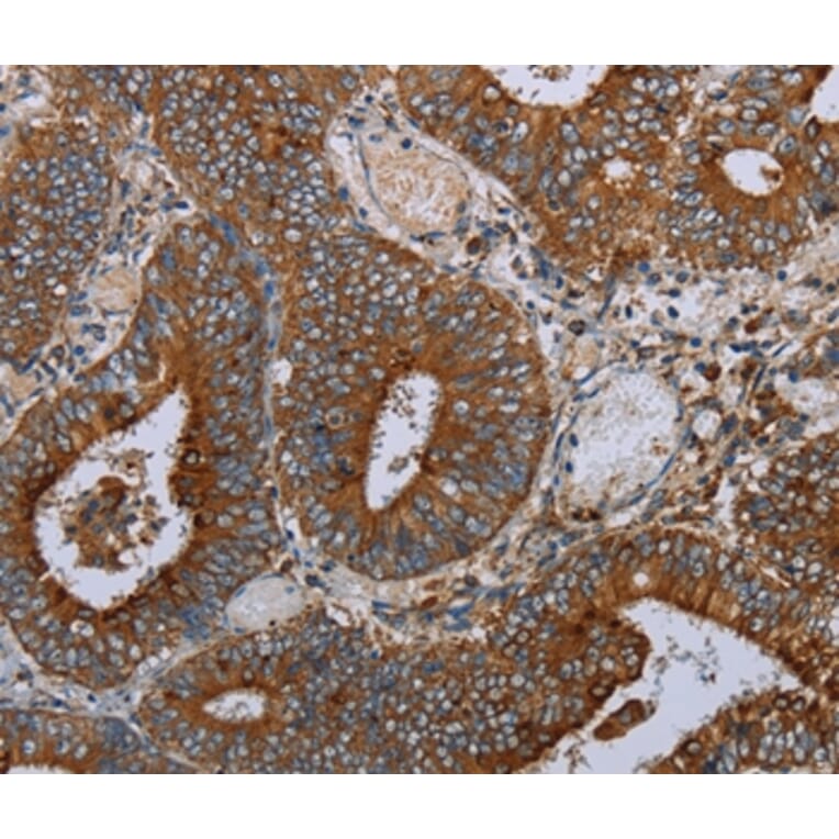 Immunohistochemistry - MAFF Antibody from Signalway Antibody (36964) - Antibodies.com