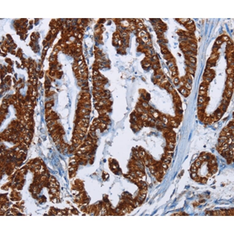Immunohistochemistry - MAFF Antibody from Signalway Antibody (36964) - Antibodies.com