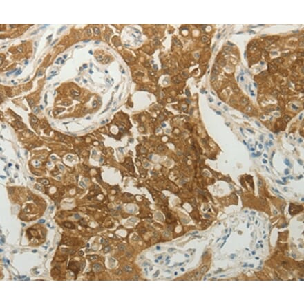 Immunohistochemistry - MC4R Antibody from Signalway Antibody (36972) - Antibodies.com