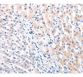 Immunohistochemistry - MTOR Antibody from Signalway Antibody (36991) - Antibodies.com