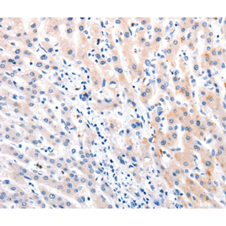 Immunohistochemistry - MTOR Antibody from Signalway Antibody (36991) - Antibodies.com