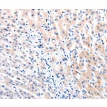 Immunohistochemistry - MTOR Antibody from Signalway Antibody (36991) - Antibodies.com