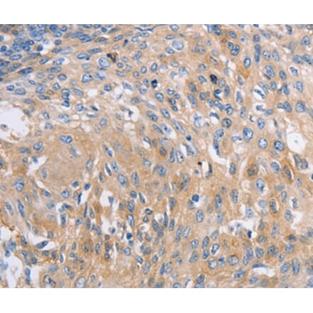 Immunohistochemistry - NBEA Antibody from Signalway Antibody (36997) - Antibodies.com