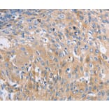 Immunohistochemistry - NBEA Antibody from Signalway Antibody (36997) - Antibodies.com