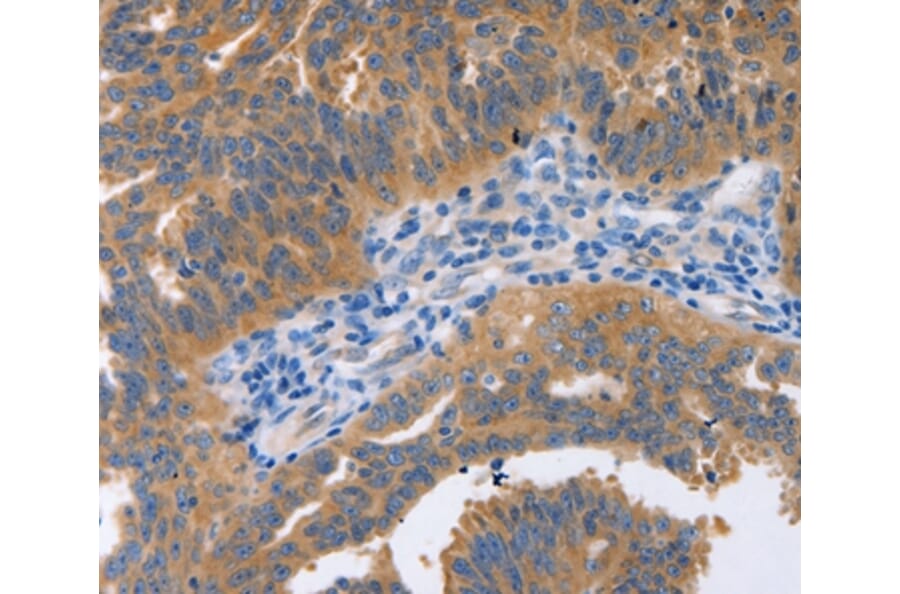 Immunohistochemistry - NBEA Antibody from Signalway Antibody (36997) - Antibodies.com