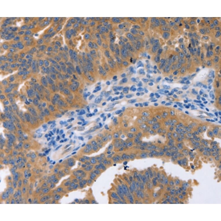 Immunohistochemistry - NBEA Antibody from Signalway Antibody (36997) - Antibodies.com