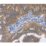 Immunohistochemistry - NBEA Antibody from Signalway Antibody (36997) - Antibodies.com