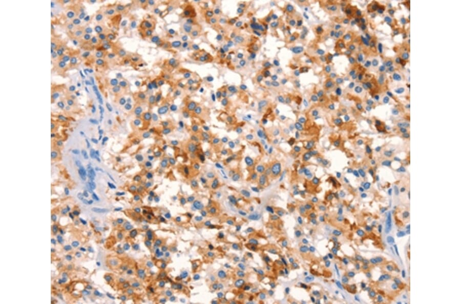 Immunohistochemistry - SPRN Antibody from Signalway Antibody (37026) - Antibodies.com