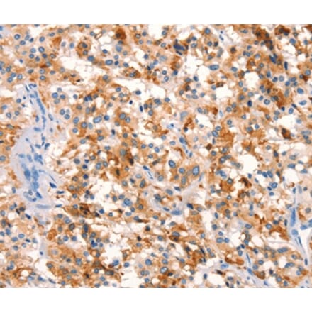 Immunohistochemistry - SPRN Antibody from Signalway Antibody (37026) - Antibodies.com