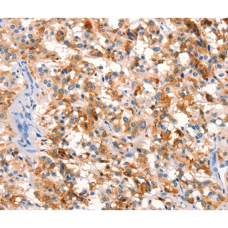 Immunohistochemistry - SPRN Antibody from Signalway Antibody (37026) - Antibodies.com